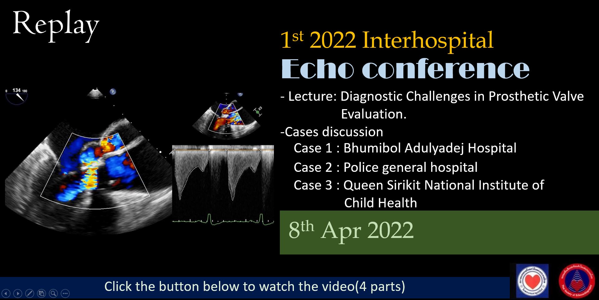 Interhospital echo conference 1/2022 Rerun Thai Society of